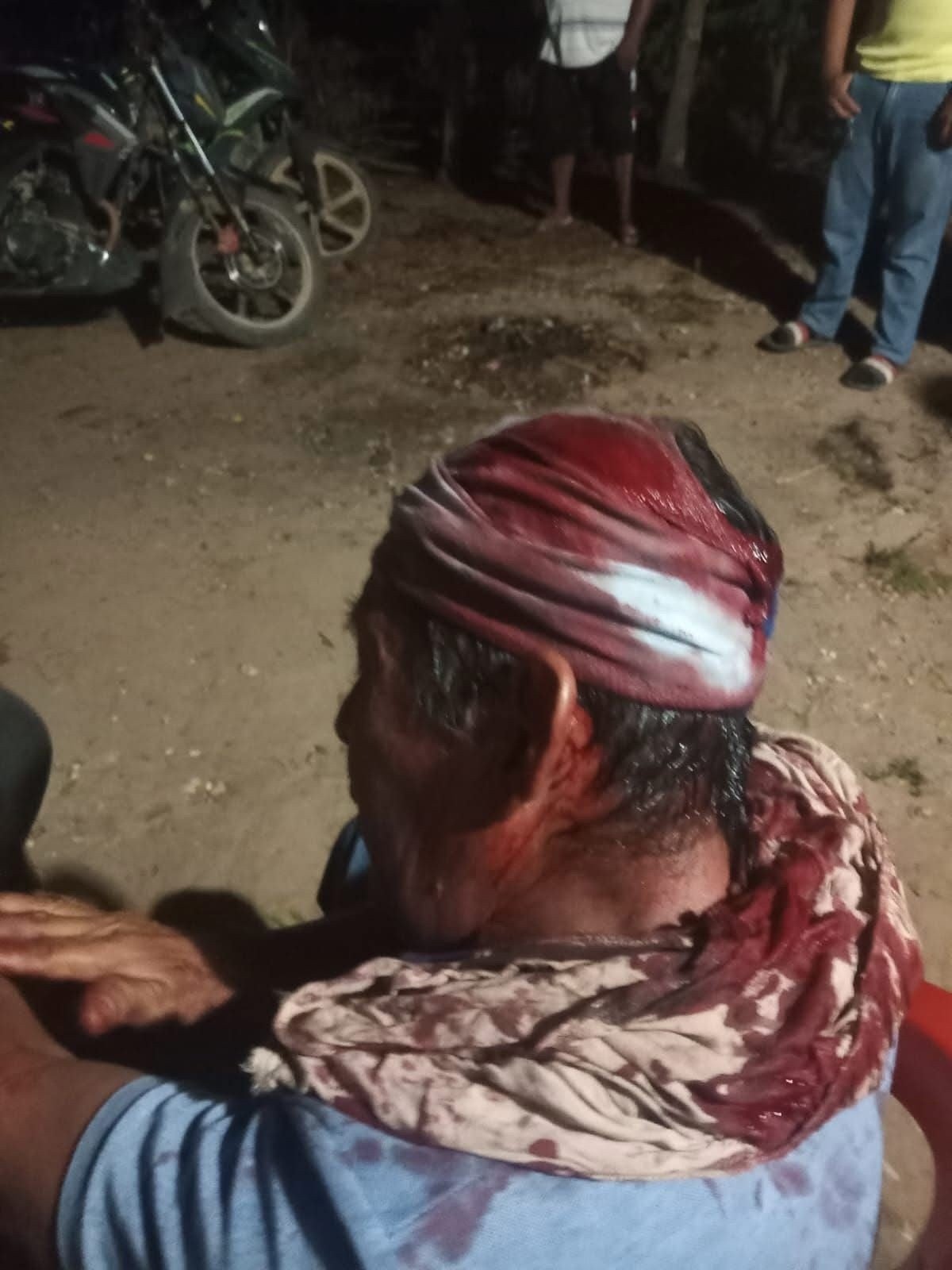 Adulto mayor fue atacado a machetazos en la comunidad de Tecuanapa Adulto mayor fue atacado a machetazos en la comunidad de Tecuanapa