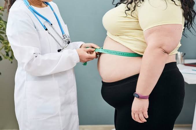Veracruz, quinto lugar nacional en casos de obesidad Veracruz, quinto lugar nacional en casos de obesidad